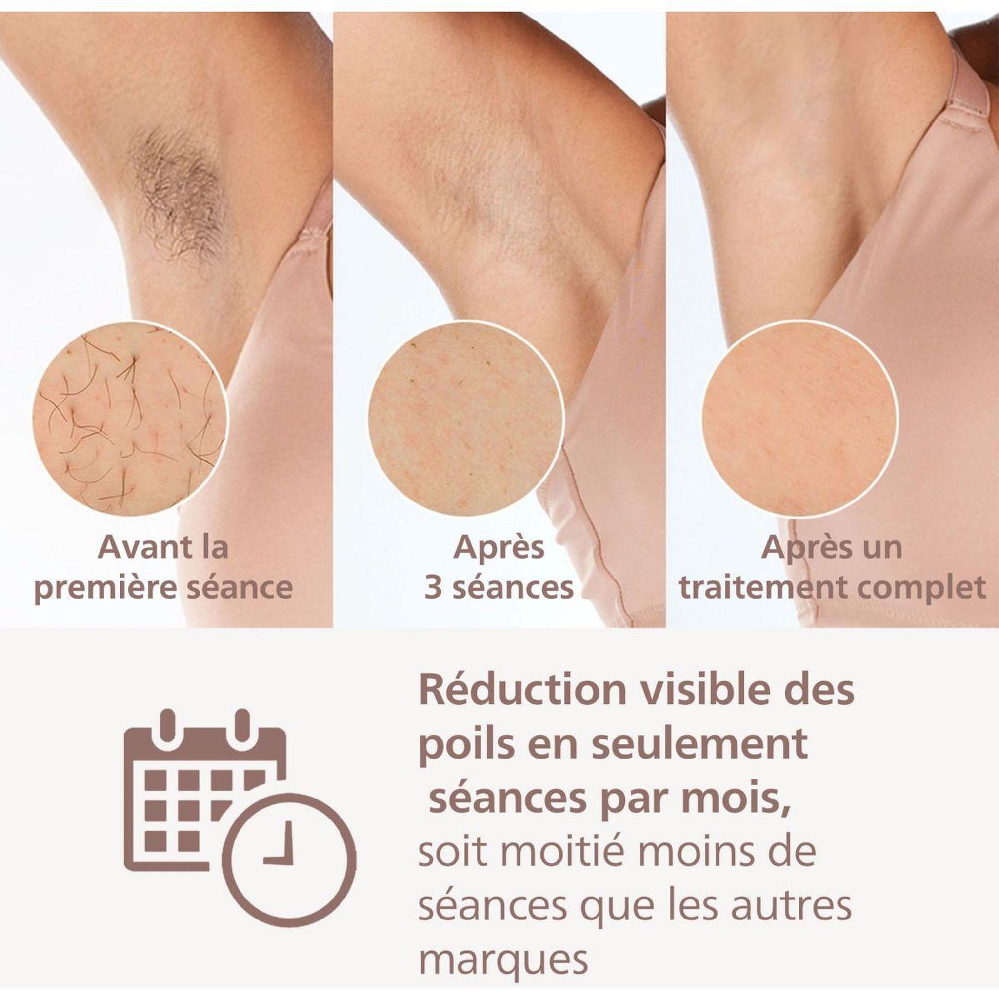 Voir la diapositive 5 : Philips Epilateur lumière pulsée lumea série 9900 bri951/01