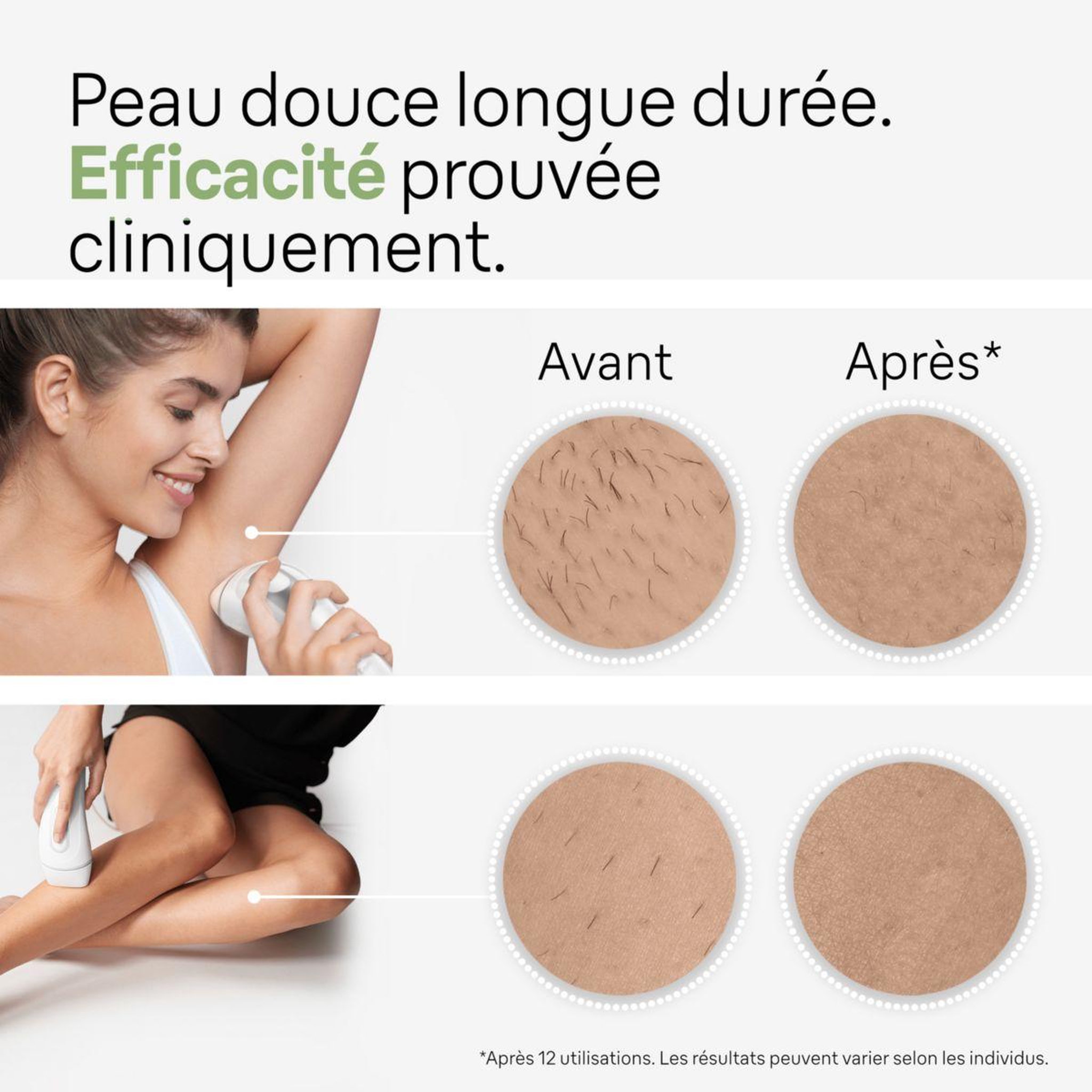 Voir la diapositive 4 : BRAUN Epilateur lumière pulsée IPL PL3122