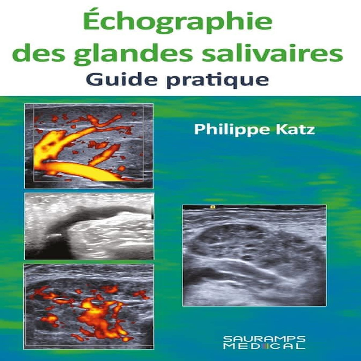 ECHOGRAGIE DES GLANDES SALIVAIRES. GUIDE PRATIQUE, Katz Philippe