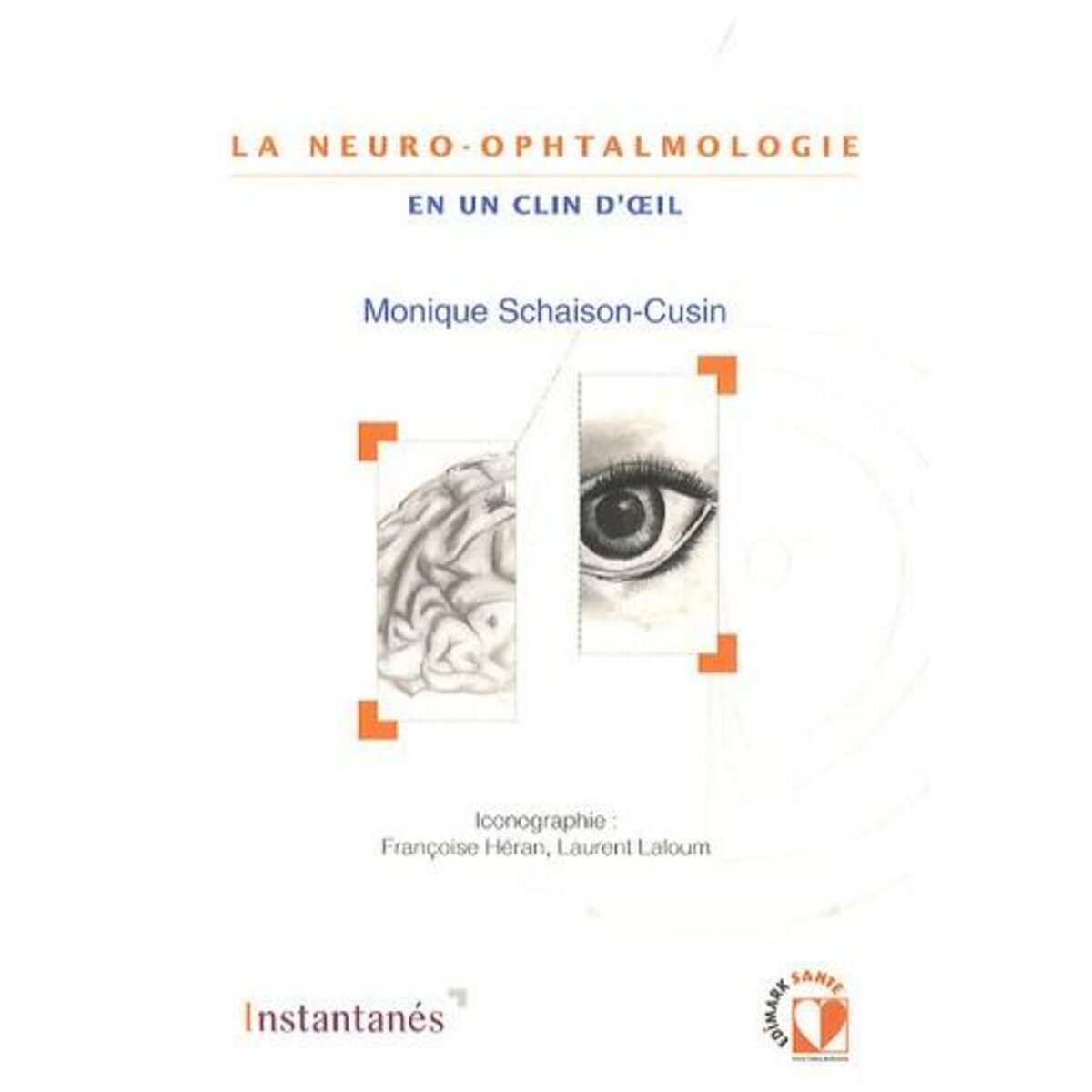 LA NEURO-OPHTALMOLOGIE EN UN CLIN D'OEIL, Schaison-Cusin Monique