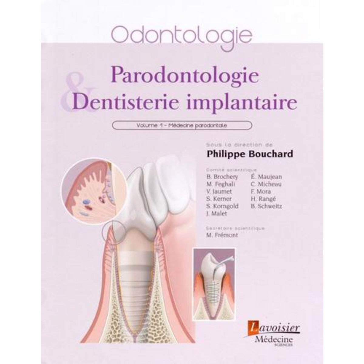 PARODONTOLOGIE & DENTISTERIE IMPLANTAIRE. VOLUME 1, MEDECINE PARODONTALE, Bouchard Philippe